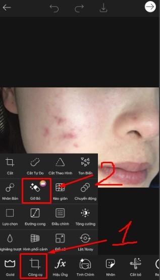Cách xóa mụn bằng Picsart trên điện thoại - chọn tính năng xóa mụn