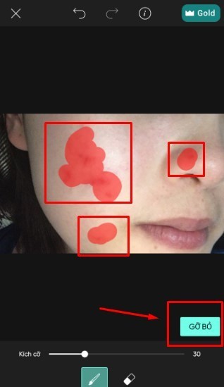 Cách xóa mụn bằng Picsart trên điện thoại - chọn vùng da mụn cần xóa